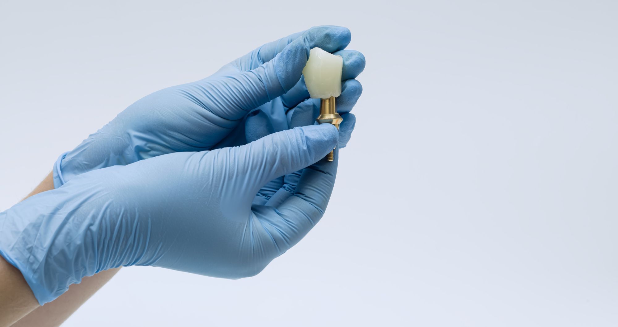 Traditional Restorations