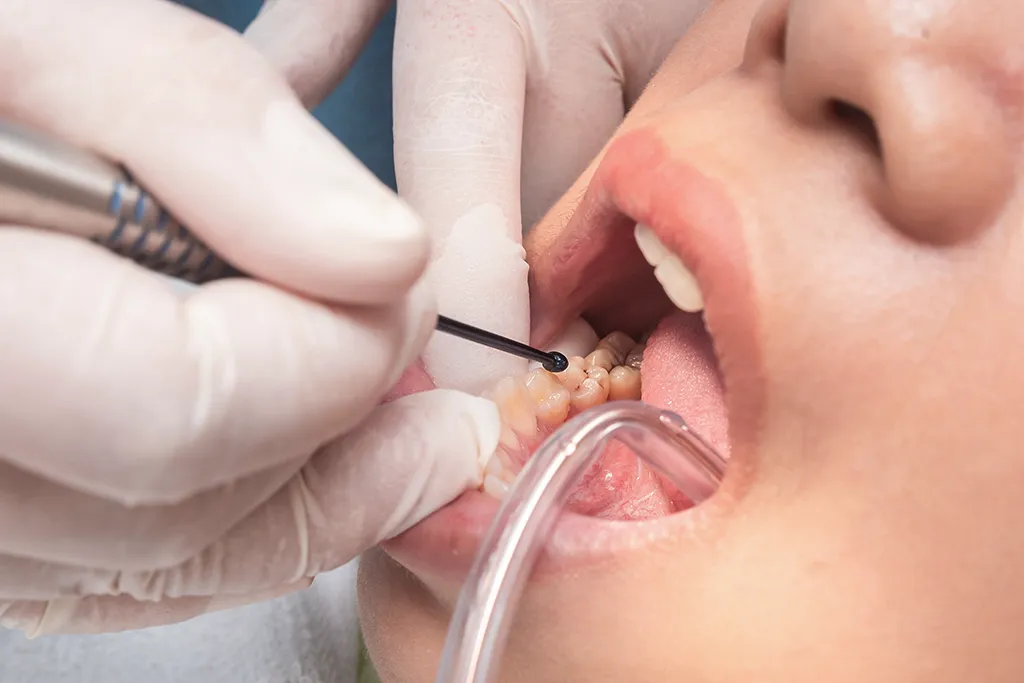 Preventive Dentistry
